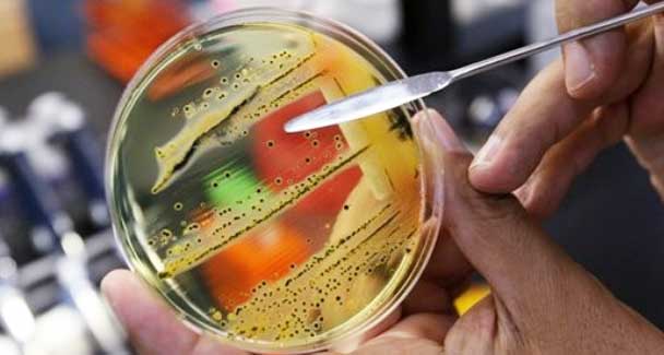 superbug-bacteria superbug-bacteria