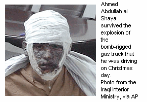 Photo: Ahmed Abdullah al Shaya survived the explosion of the bomb-rigged gas truck that he was driving on Christmas day.