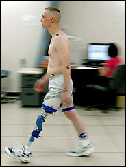 Sgt. Luke Wilson, who lost a leg in Iraq, walks with a device known as a C-leg while technicians use a computer to monitor it at Walter Reed Army Medical Center. The center has fitted 100 soldiers with artificial arms and legs, including state-of-the-art devices unavailable to the public. (Doug Mills/The New York Times)