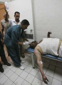 A man who was wounded in a bomb attack receives treatment at a hospital in Kerbala, 80 km (50 miles) southwest of Baghdad August 4, 2008. Four civilians were wounded when a bomb inside a minibus expolded in Kerbala on Monday, police said. Picture taken August 4, 2008. REUTERS/Mushtaq Muhammed (IRAQ)
